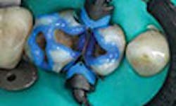 LaserFousWorld Test LaserFousWorld Test