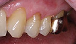 LaserFousWorld Test LaserFousWorld Test