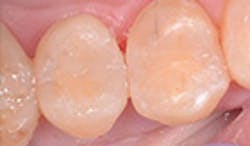 LaserFousWorld Test LaserFousWorld Test