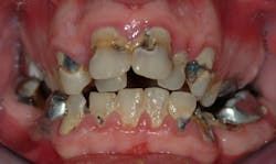 1904dechr P03 1904dechr P03