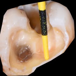 1904delin P01 1904delin P01