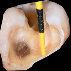 1904delin P01 1904delin P01