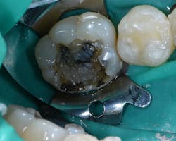 1904delin P04 1904delin P04