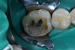 1904delin P05 1904delin P05