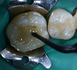 1904delin P06 1904delin P06