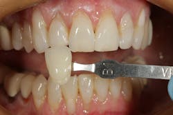 1904delow P02 1904delow P02