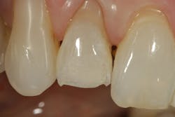 1904delow P03 1904delow P03