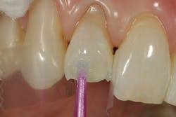 1904delow P05 1904delow P05