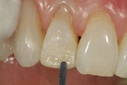 1904delow P06 1904delow P06