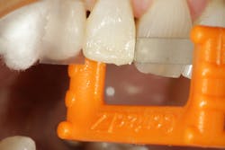 1904delow P07 1904delow P07