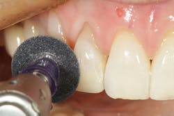 1904delow P10 1904delow P10