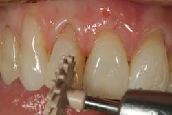 1904delow P11 1904delow P11