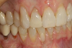 1904delow P12 1904delow P12