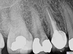 1904dezur P06 1904dezur P06