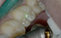 1905defro P02 1905defro P02