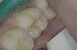 1905defro P03 1905defro P03