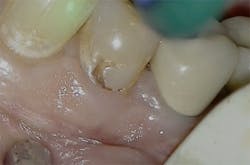 1905defro P04 1905defro P04