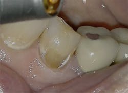 1905defro P05 1905defro P05