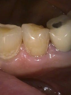 1905defro P06 1905defro P06