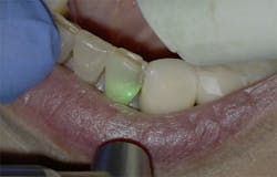 1905defro P07 1905defro P07