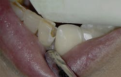 1905defro P08 1905defro P08