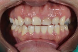 1905defro P09 1905defro P09