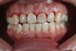 1905defro P10 1905defro P10