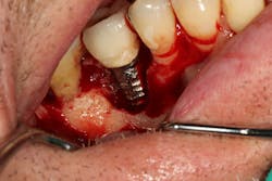 1905defro P11 1905defro P11