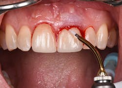 1905defro P12 1905defro P12