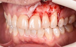 1905defro P13 1905defro P13