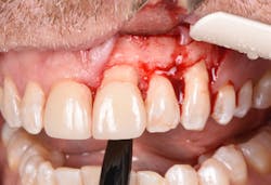 1905defro P14 1905defro P14