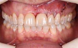 1905defro P15 1905defro P15