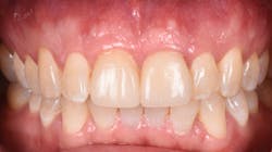 1905defro P16 1905defro P16