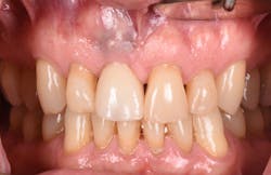 1905defro P17 1905defro P17