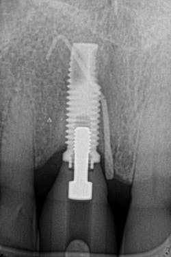 1905defro P18 1905defro P18