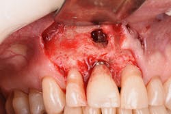 1905defro P21 1905defro P21