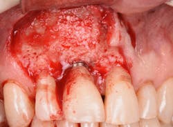 1905defro P22 1905defro P22