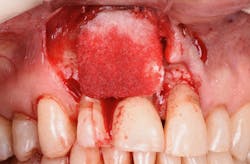 1905defro P23 1905defro P23