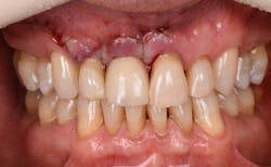 1905defro P24 1905defro P24