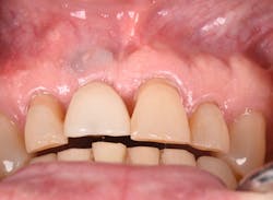 1905defro P25 1905defro P25