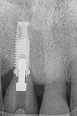 1905defro P26 1905defro P26