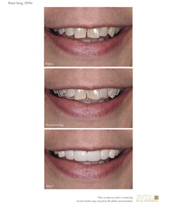 1905desan P04 1905desan P04