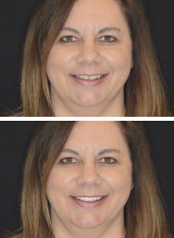 1905desan P05 1905desan P05