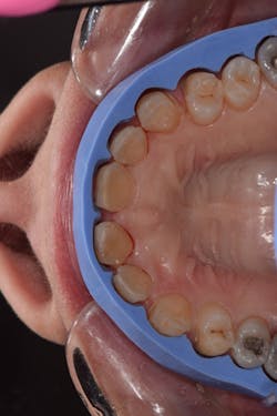 1905desan P06 1905desan P06