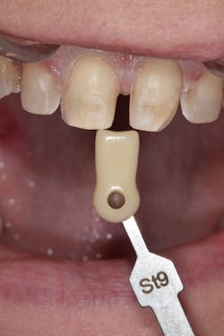 1905desan P08 1905desan P08