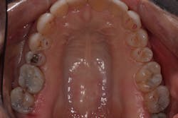 1905desan P10 1905desan P10