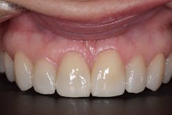 1905desan P11 1905desan P11