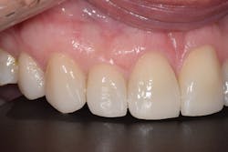 1905desan P12 1905desan P12