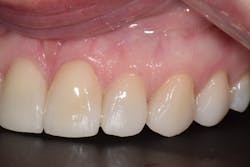 1905desan P13 1905desan P13