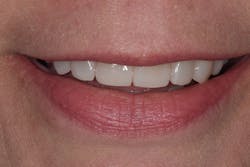 1905desan P14 1905desan P14